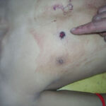 cadavere