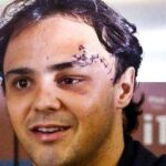 Felipe Massa