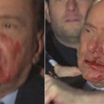 berlusconi-ferito