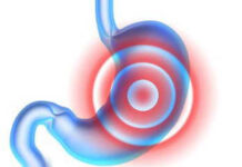 Alimentazione, come combattere gastrite e aciditá