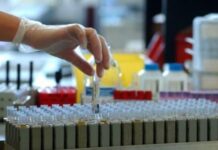 Policlinico di Palermo, test sul sangue e terapie monoclonali per vincere la sfida contro l’Alzheimer