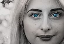 Acne, istruzioni per l’uso